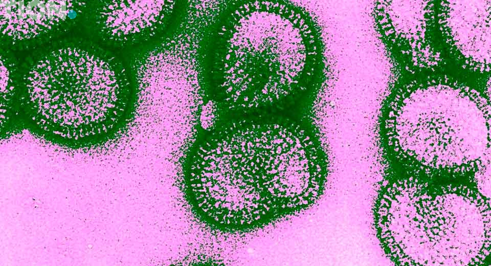 Вирус гриппа H3N2 под микроскопом